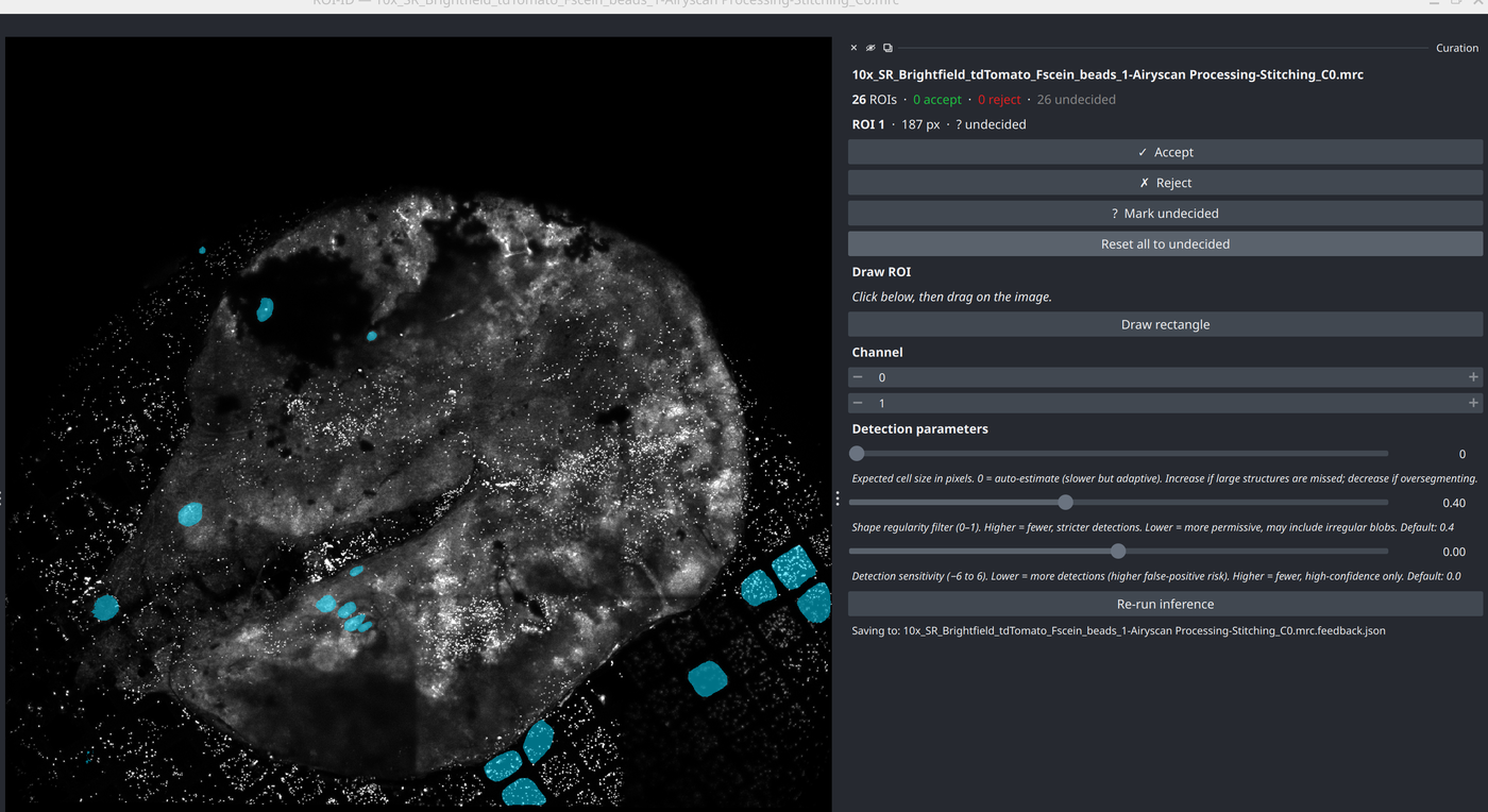 ROI-ID · Astrocyte thumbnail